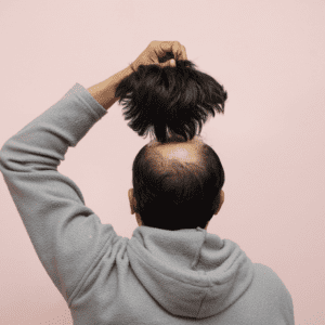 Stock Hair System